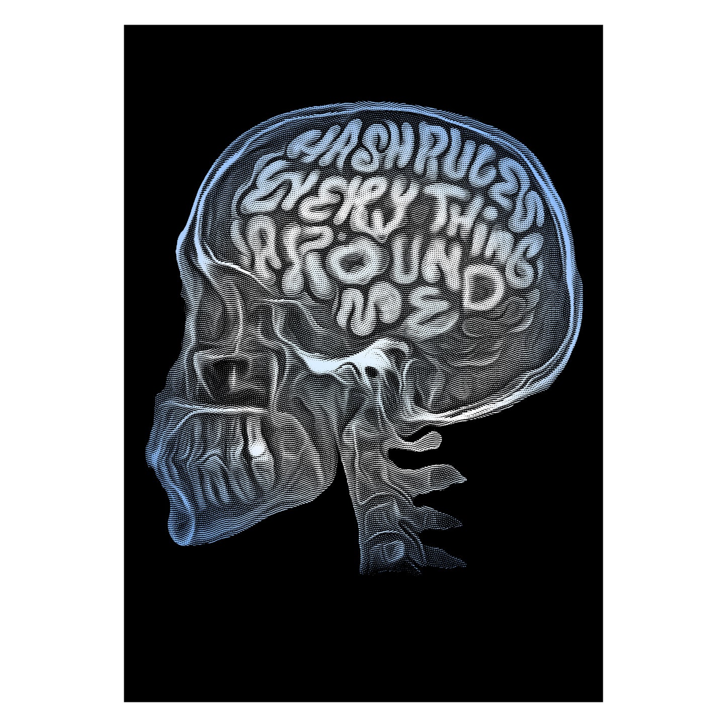 Hream X-ray A3 Art Print